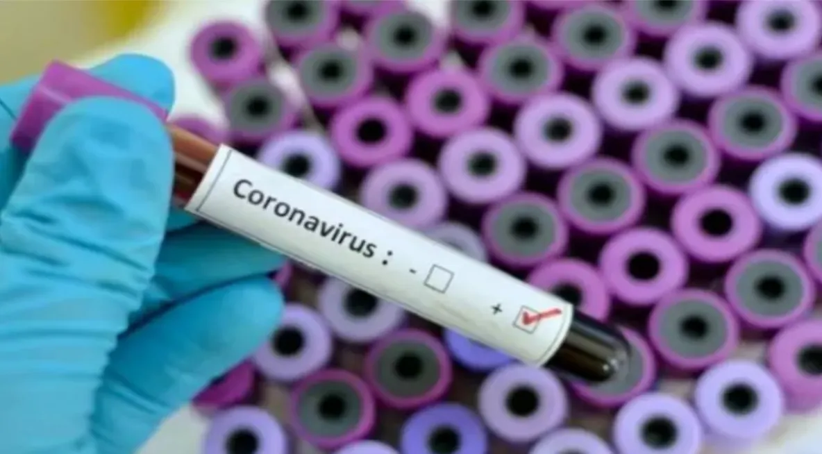 Coronavirus-România. Informare MAI-29 februarie (ora 11.00)
