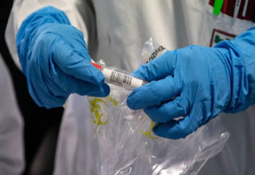 COVID-19: O săptămână cu peste 1000 de cazuri. Câte cazuri noi sunt în județe
