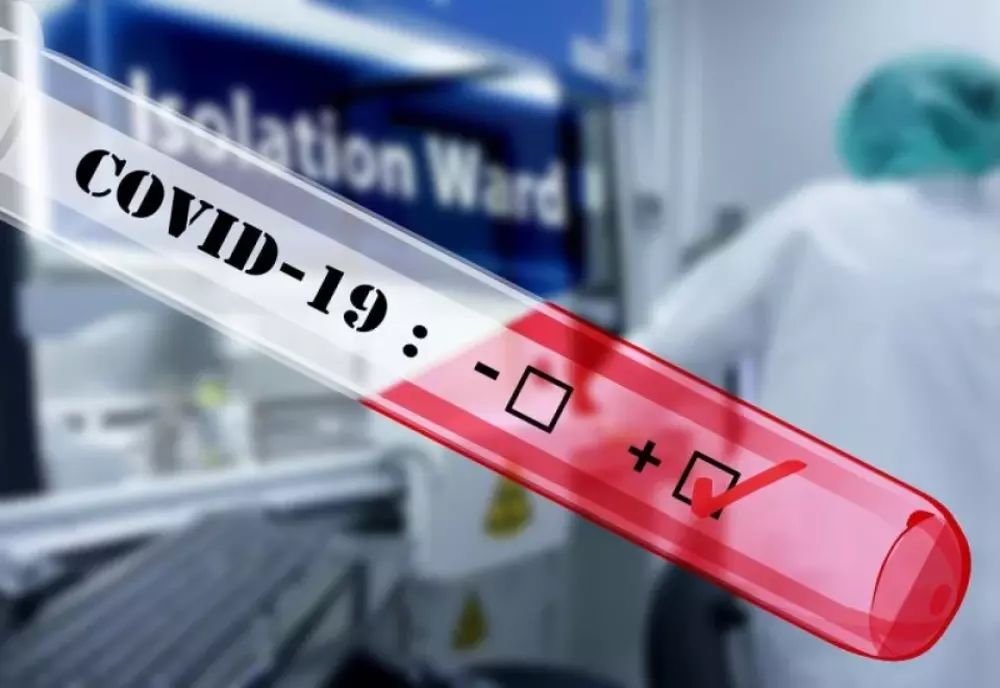 În ultimele 24 de ore s-au confirmat 263 de noi cazuri de îmbolnăvire cu COVID-19