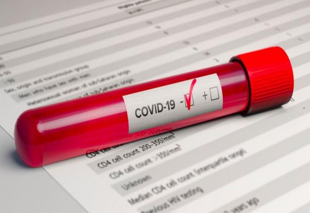 Au fost confirmate 1.452 de cazuri de persoane infectate cu virusul COVID – 19