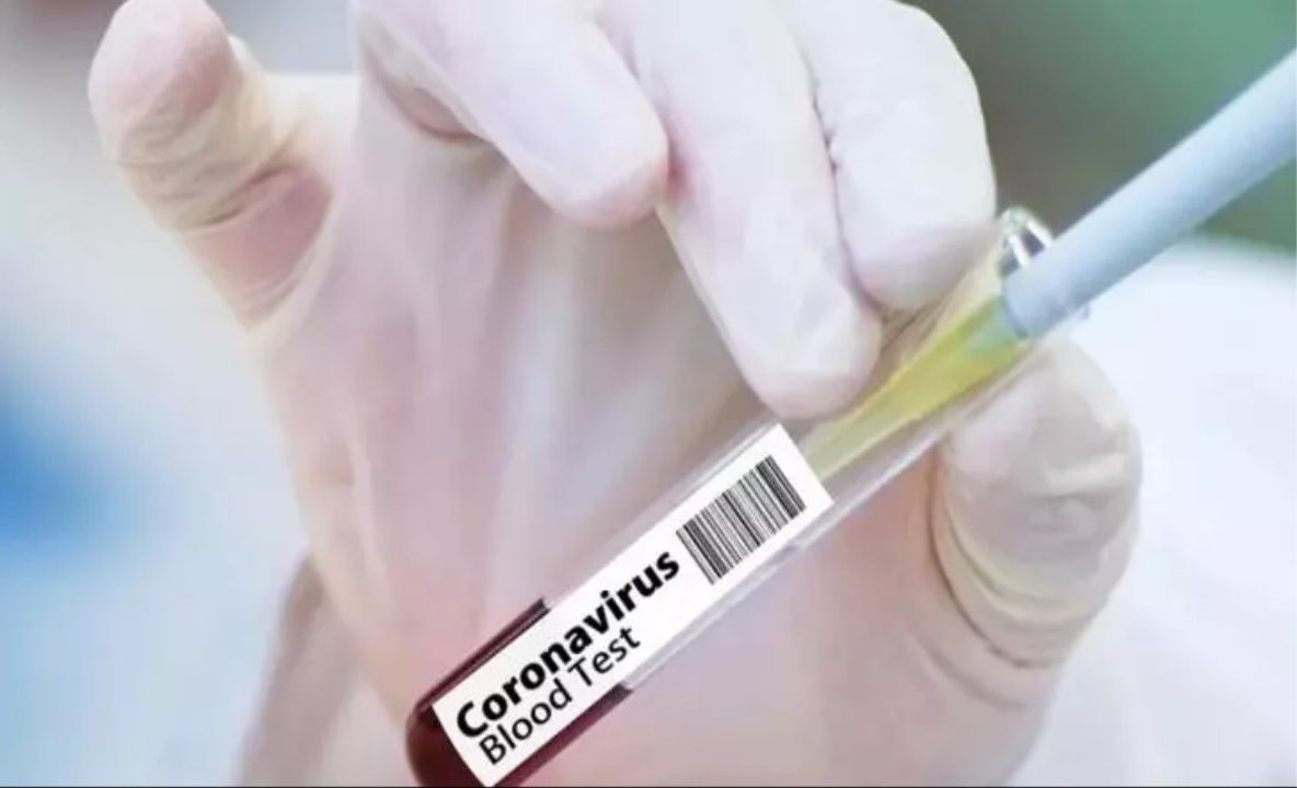 Bilanțul deceselor în România, actualizat: 205 persoane infectate cu coronavirus au murit. Între victime, o femeie de 38 de ani