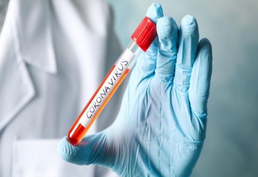 Doar 2 cazuri noi de coronavirus, în Dâmbovița, în ultimele 24 de ore (total 282 cazuri). La nivel național 191 cazuri noi