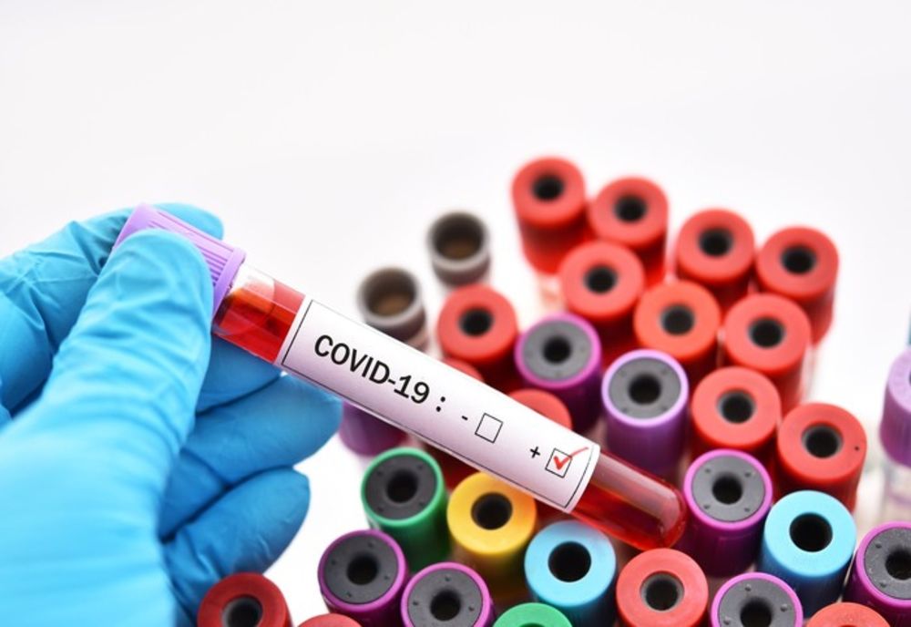 Încă o zi cu creștere importantă de cazuri de coronavirus-320. În Dâmbovița 14 cazuri și un deces