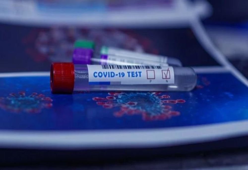 Numărul cazurilor noi de infectări cu coronavirus rămâne ridicat. 413 cazuri noi și 17 decese înregistrate în ultima zi