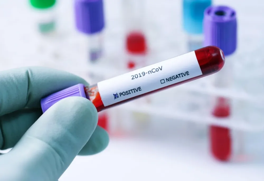Record de cazuri de coronavirus. În ce județe sunt cele mai multe infectări