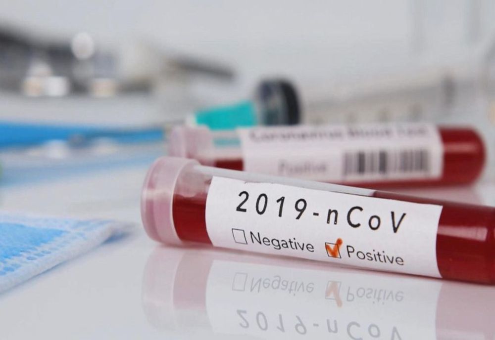 29 noi cazuri de coronavirus în România. Bilanțul ajunge la 246 de infectări