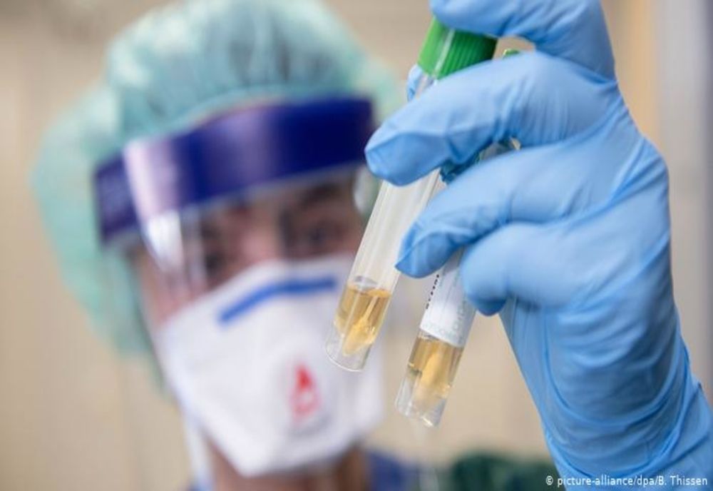 Autoritățile au raportat încă trei decese cauzate de infecția cu coronavirus. Toate cele trei victime sunt din județul Ialomita.