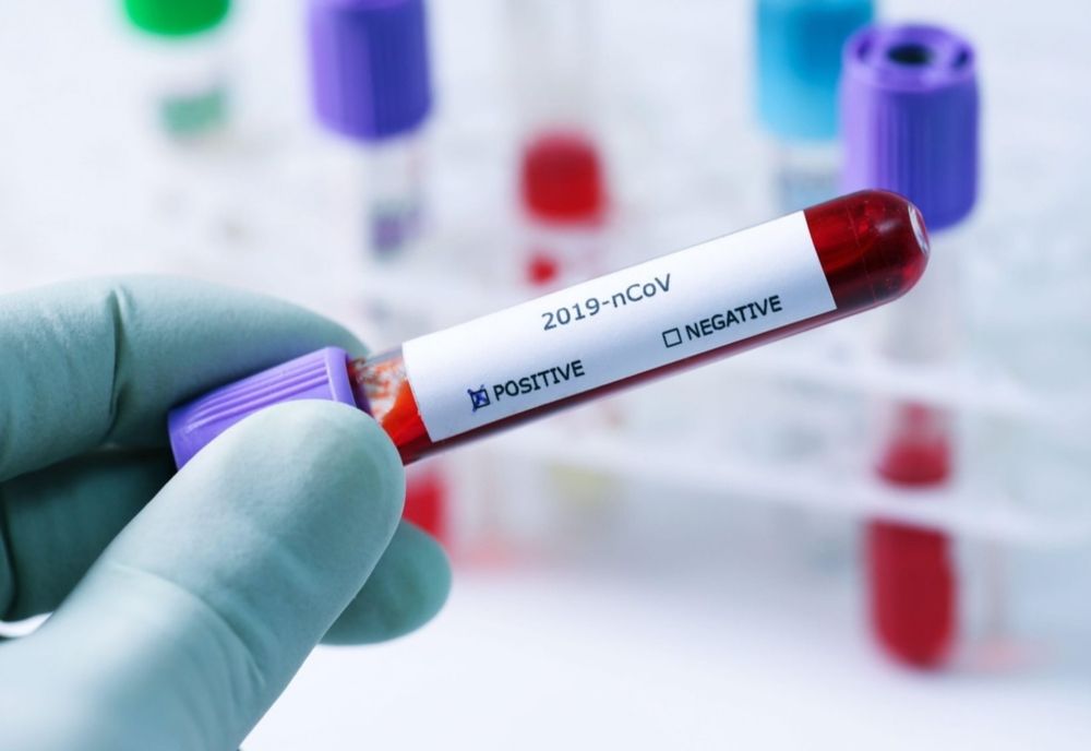 Record de cazuri de coronavirus. În ce județe sunt cele mai multe infectări