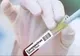 Bilanțul deceselor în România, actualizat: 205 persoane infectate cu coronavirus au murit. Între victime, o femeie de 38 de ani