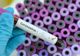 Alertă! Epidemia de coronavirus face ravagii. Sfaturi utile pentru românii din Italia dar și din țară