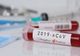 Al patrulea pacient cu coronavirus decedat în România
