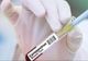 Bilanțul deceselor în România, actualizat: 205 persoane infectate cu coronavirus au murit. Între victime, o femeie de 38 de ani