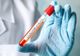 Doar 4000 de teste, în ultimele 24 de ore. 246 de cazuri noi de coronavirus. Două sunt în Dâmbovița (+2 noi decese)